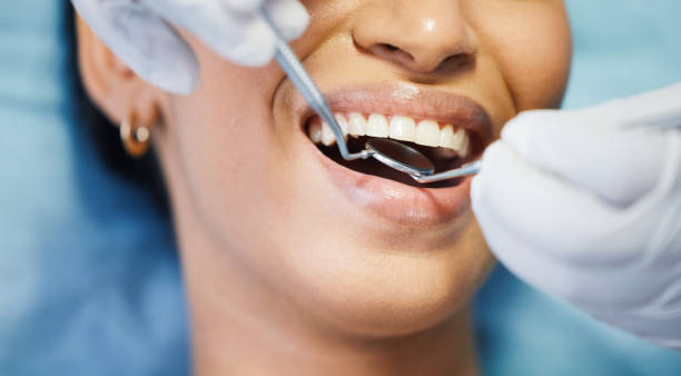 Best Emergency Treatment for Dental Infections or Abscesses in Goodwater, AL