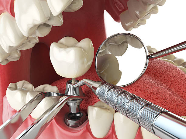 Best Emergency Dental Care for Broken or Chipped Teeth in Goodwater, AL